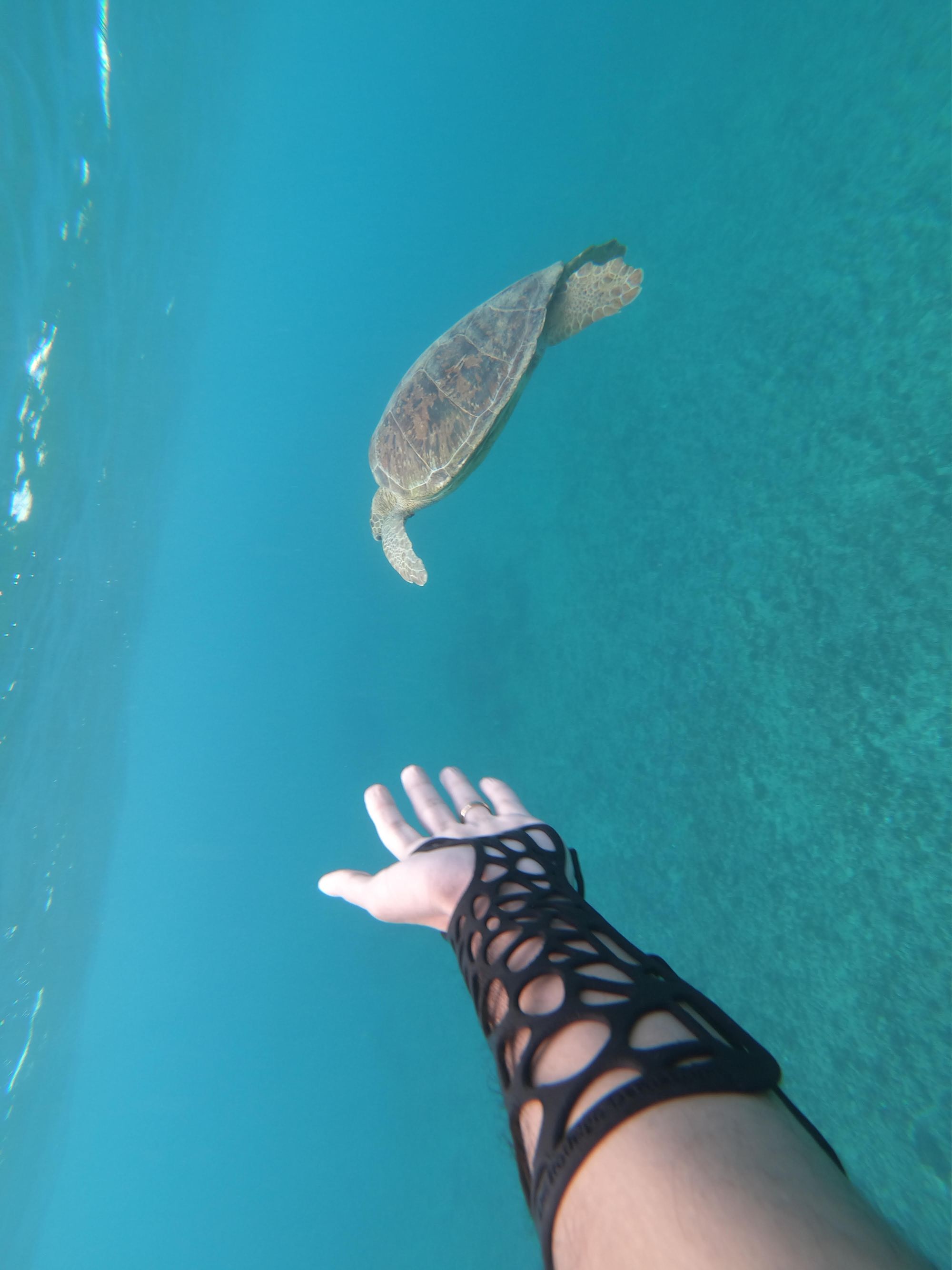 Fix it vende 5 mil órteses no 1º semestre de 2021 e se prepara para expandir negócio pelo mundo