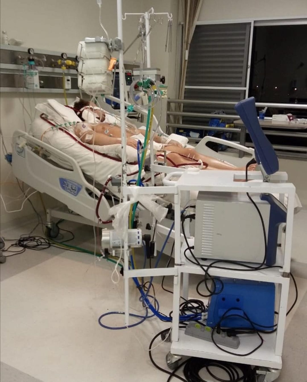 Balanços da pandemia: Covid-19 levou a aumento de procedimentos de alta complexidade