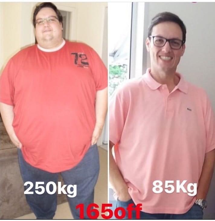 Dia Mundial da Obesidade (4/3): pesquisas indicam que um em cada quatro brasileiros será obeso em 2030
