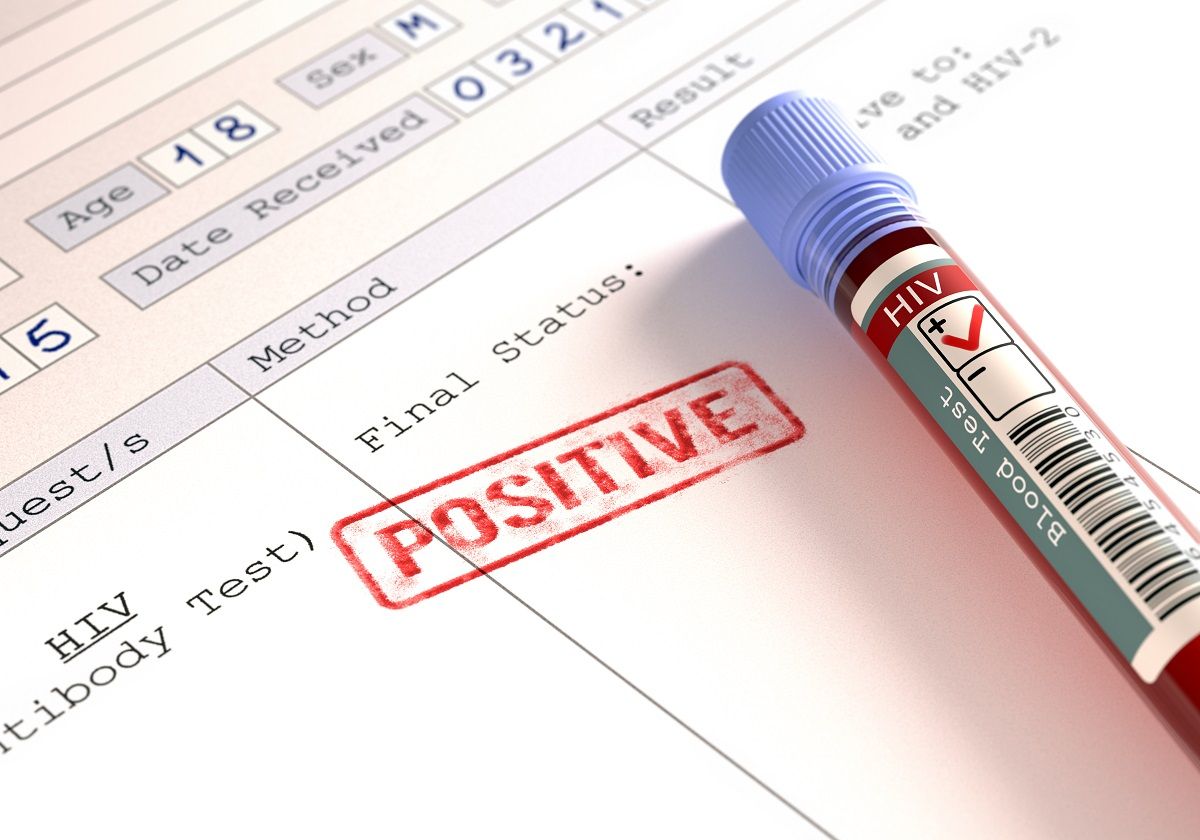 Com nova variante, mais transmissível e agressiva, especialistas alertam para importância do diagnóstico precoce do HIV
