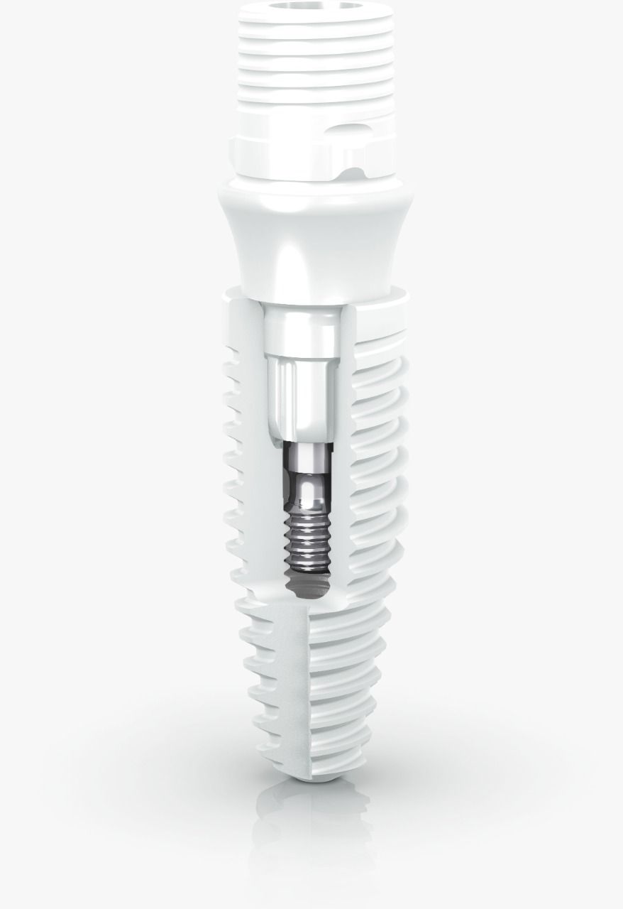 IN2022 é palco de lançamento do Neodent® Ceramic Implant System, implante de cerâmica que traz novo mindset de flexibilidade, estabilidade e estética
