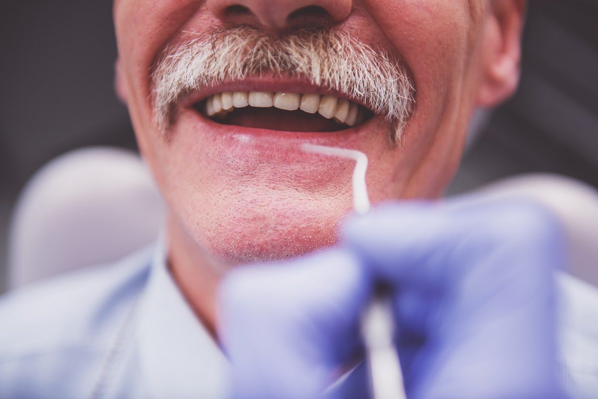 Perda de dentes aumenta em 28% riscos de demência